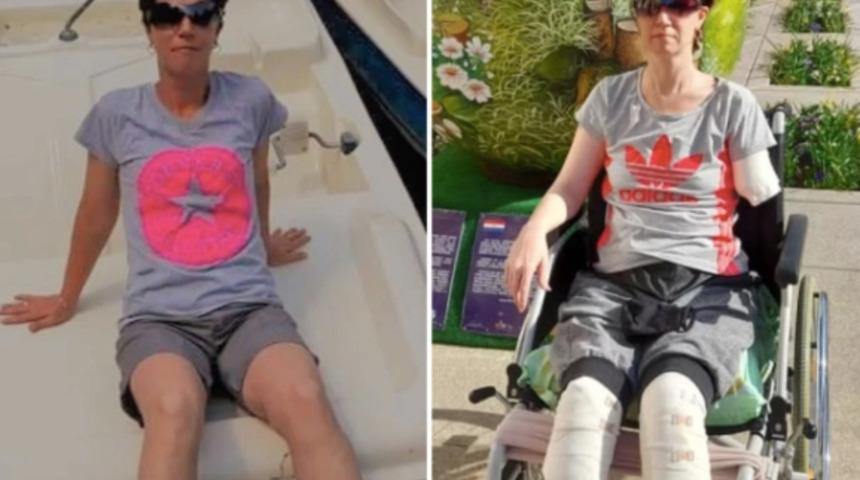 Karın ağrısı şikayetiyle gitti, üç uzvunu kaybetti: Canlı bir ölüyüm