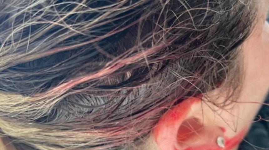 Avustralya'da tepki çeken karar! Saksağanlar itlaf edilecek