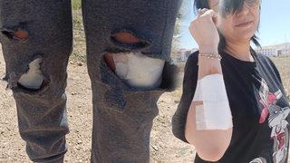 12 köpeğin saldırısına uğrayan kadın canını zor kurtardı!