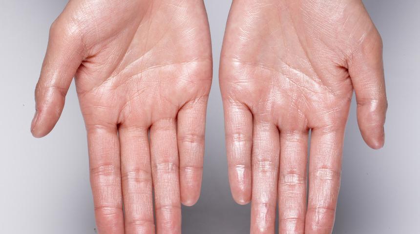 Aşırı terlemek farklı hastalıkların habercisi olabilir! Mutlaka test yaptırın