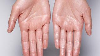 Aşırı terlemek farklı hastalıkların habercisi olabilir! Mutlaka test yaptırın