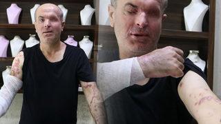 İzmir'de korkunç olay! Sol gözünü kaybetti, vücudunda yanıklar oluştu