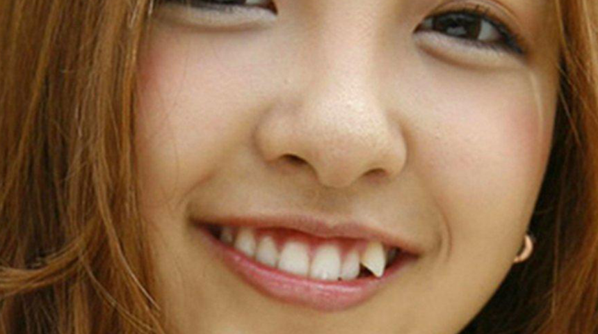 Japonlar’ın tuhaf güzellik geleneği: Çarpık diş modası