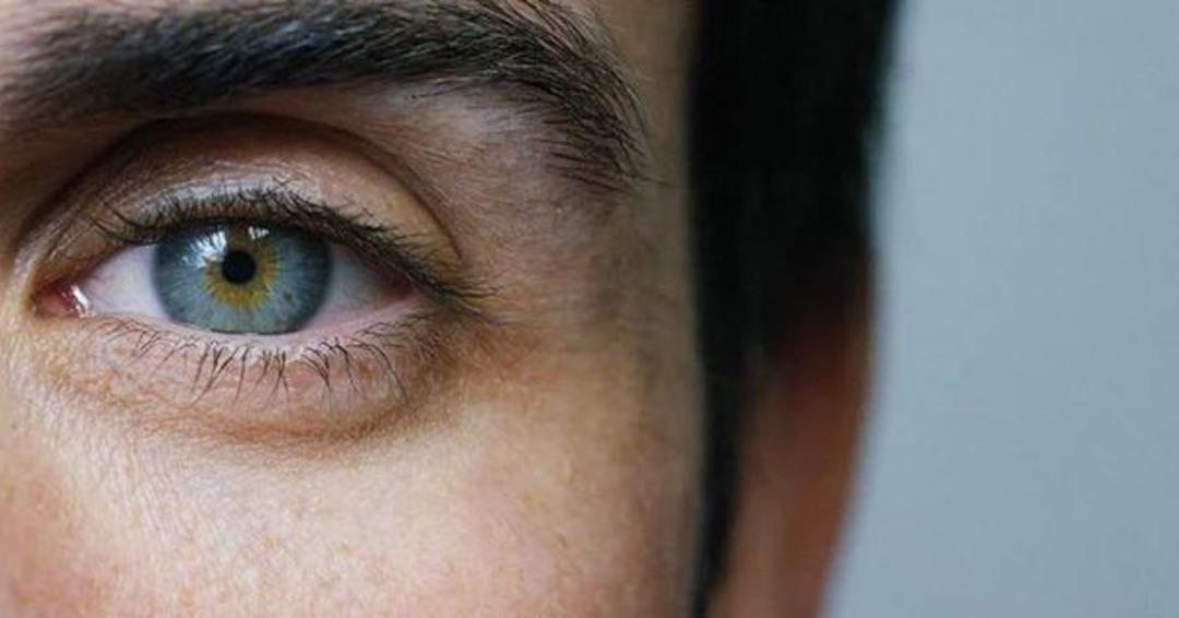 Kadir İnanır'ın yakalandığı Sarı nokta hastalığı nedir?