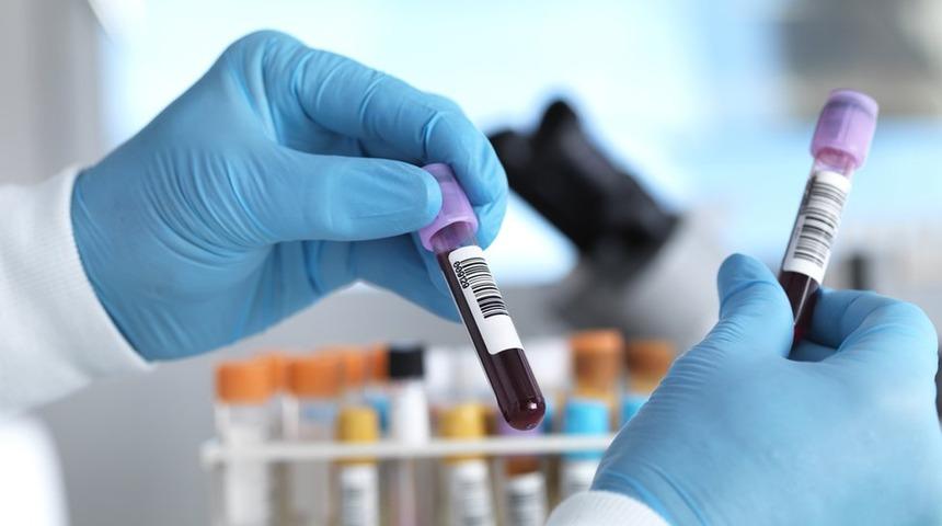 Kanser: İngiltere'de 50'den fazla kanser türünü erken teşhis etmesi umulan kan testi deneniyor