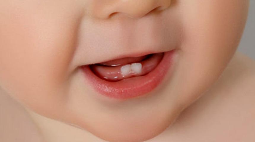 Çocuğunuzun süt dişini çürütmeyin