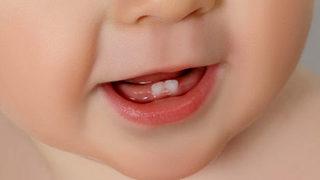 Çocuğunuzun süt dişini çürütmeyin