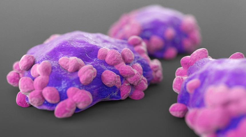 Lenfoma erkeklerde daha sık görülüyor