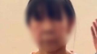 Tedavisi yok! Yüzü hızla yaşlanıyor: Beni neden doğurdunuz?