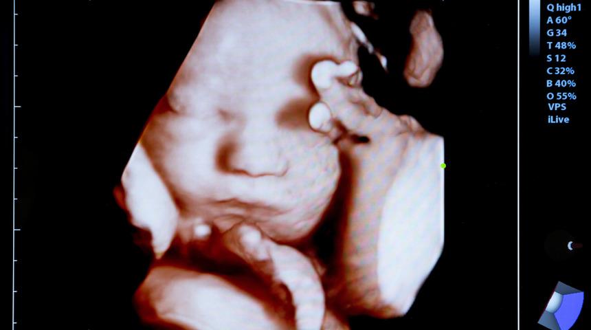 Bebeğinizi doğmadan görün