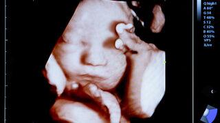 Bebeğinizi doğmadan görün