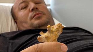 Böbreğinde taşla yaşayacaksın denilen Özbek hasta, şifayı Türkiye'de buldu