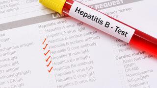 5 milyon Hepatit B taşıyıcısı var