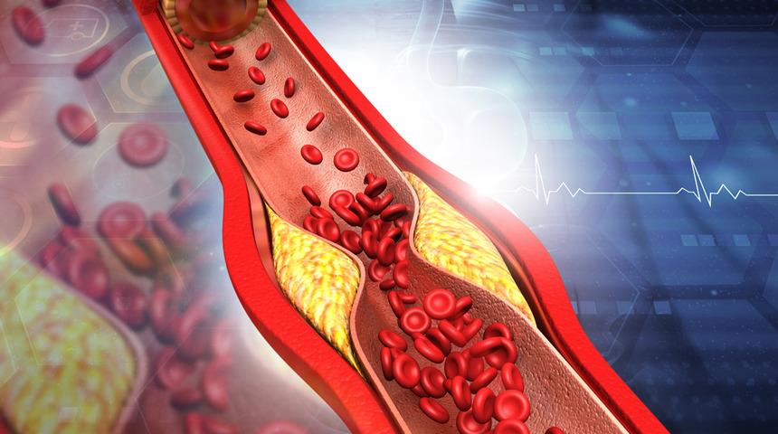 Kolestrol insanı yaşlı gösteriyor