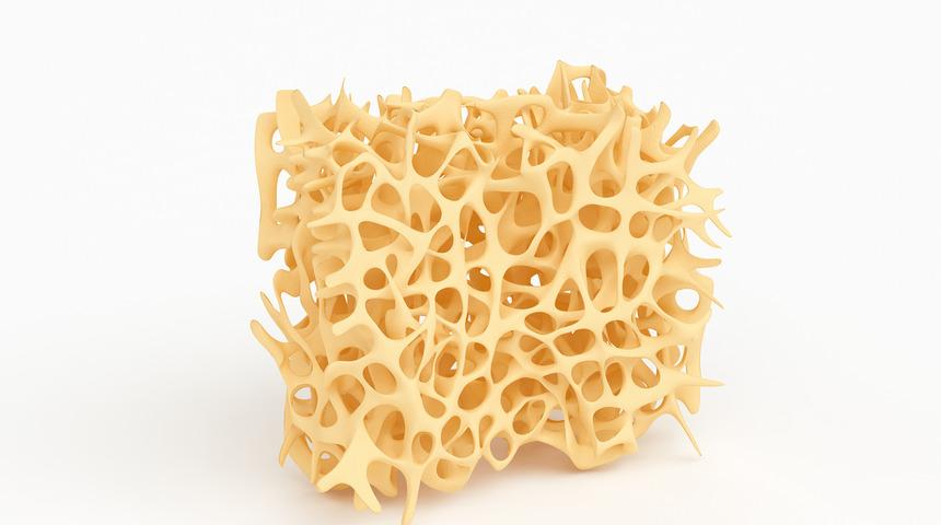 Osteoporoz erkekleri de tehdit ediyor