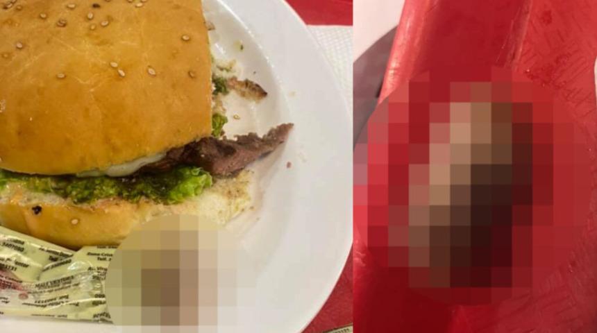 Bolivya'da bir kadının hamburgerinden insan parmağı çıktı