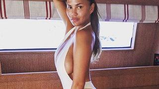 Chrissy Teigen yanaklarındaki yağları aldırdı