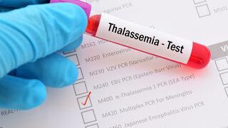 Talasemi hastaları dergi çıkardı
