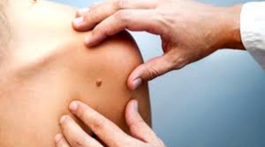 Bilinçsiz güneşlenmede ölüm riski