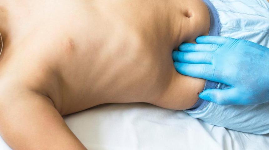 Apandisit ağrısı nasıl ayırt edilir öğrenin