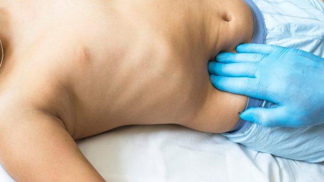 Apandisit ağrısı nasıl ayırt edilir öğrenin