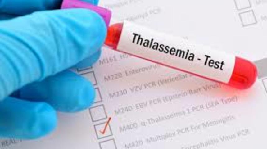 Talasemi hastalarına müjde