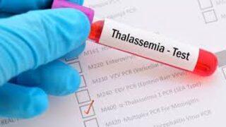 Talasemi hastalarına müjde