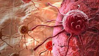 Mide kanserinin çaresi vücutta mı?