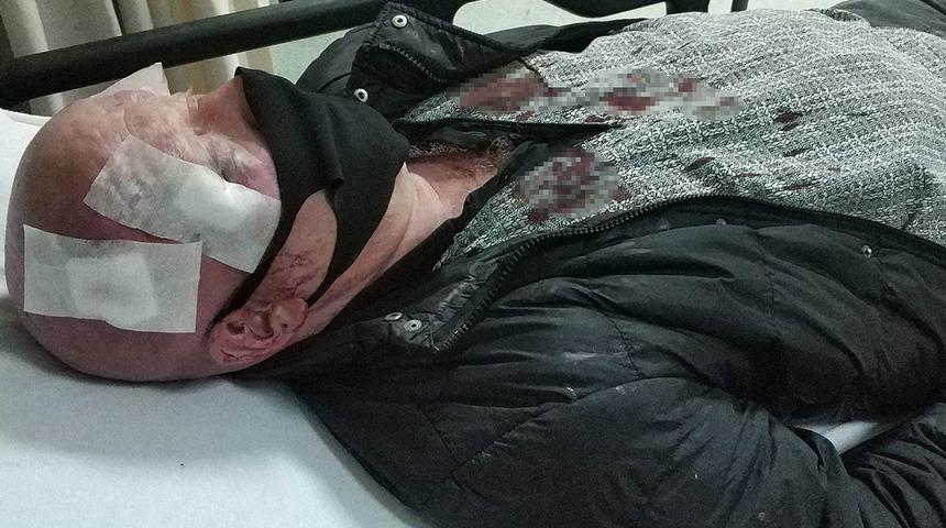 Zurnacıya davul tokmaklı saldırı