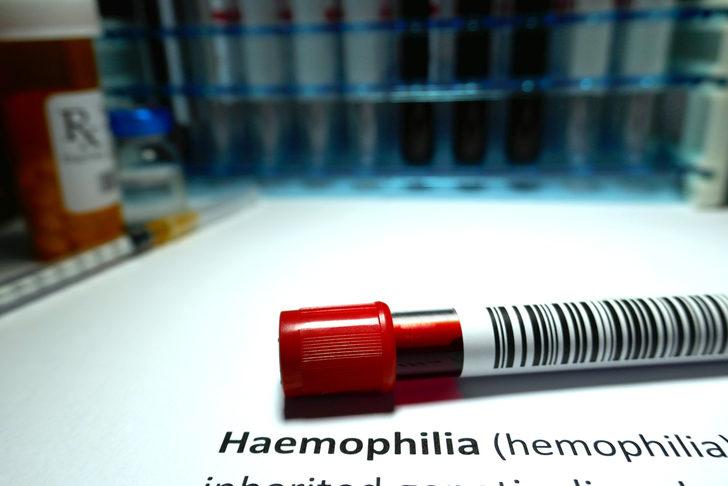 Dünyada 500 bin hemofili hastası var