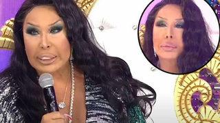 Bülent Ersoy'un yüzündeki değişimin sebebi estetik değilmiş!