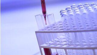 Bozuk genden kurtuluş yok