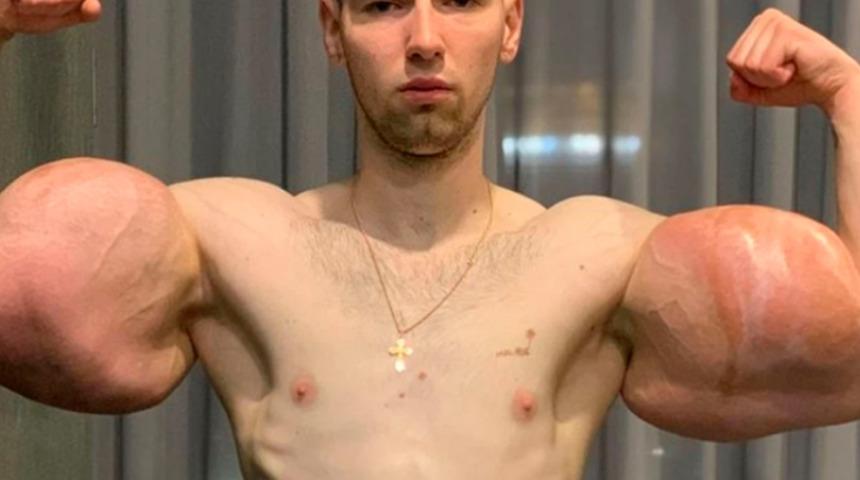 Temel Reis lakaplı kafes d&ouml;v&uuml;şc&uuml;s&uuml; &ouml;l&uuml;mle burun buruna: Bu k&acirc;bustan uyanmak istiyorum