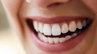 Ameliyatsız gummy smile tedavisi