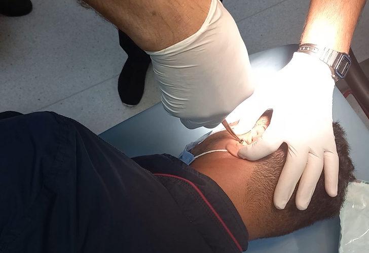 Akıllara durgunluk veren kopya düzeneği! Kulağından hastanede çıkartılabildi G2