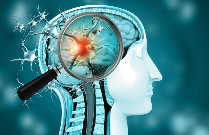 Uyuşukluk hissine dikkat! Beyin tümörünüz olabilir G5