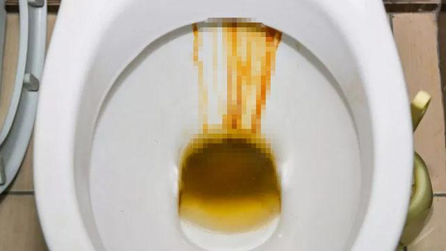 Evinizi mikroplar işgal etmesin! Klozet temizliğini etkili bir şekilde tamamlamanız için tüyolar