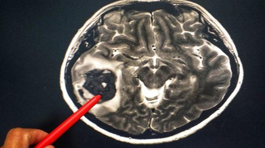 Grip, zatürree ve beyin iltihabına yol açabiliyor