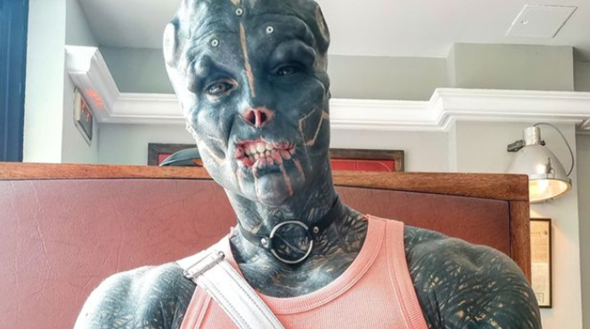 Burnunu bile aldırdı! Uzaylı gibi görünmek için yüzüne çeşitli modifiyeler yaptıran fenomen: Anthony Loffredo