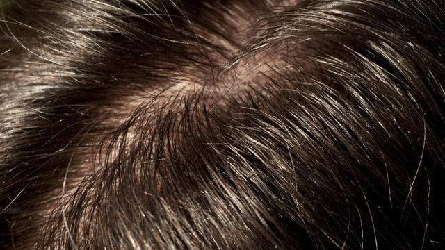 Eğer bu detaylara dikkat etmeden bakım yaparsanız saçlarınız mahvolabilir!