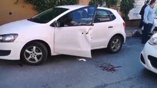 Akılalmaz kaza! Beyin cerrahının parmakları koptu, hastaneye koştu