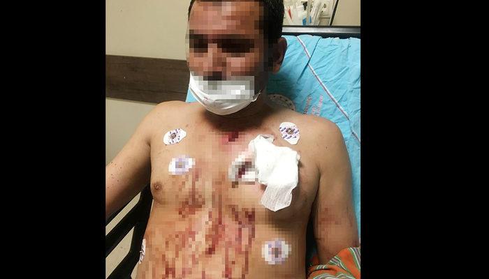 Uygunsuz fotoğraflarını sosyal medyada paylaşan erkek arkadaşını göğsünden bıçakladı