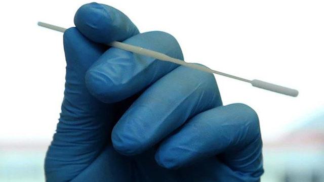 ABD'de şaşırtan olay! Koronavirüs testine dudak uçuklatan fatura