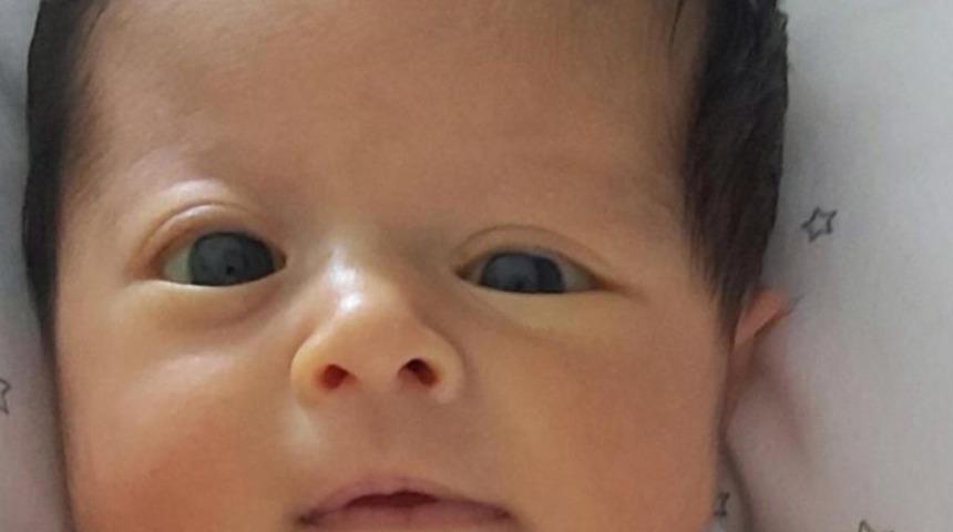 2 aylık Lina’nın kafatası kemiklerindeki deformasyon ameliyatla düzeltildi: 'Başına tülbent bağla' dediler