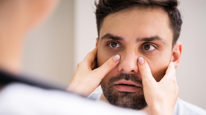 Sinüzit belirtileri nedir, tedavisi nasıl olur? Baş ağrısı nedenler arasında yer alıyor