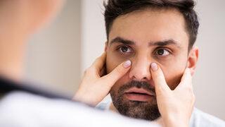 Sinüzit belirtileri nedir, tedavisi nasıl olur? Baş ağrısı nedenler arasında yer alıyor