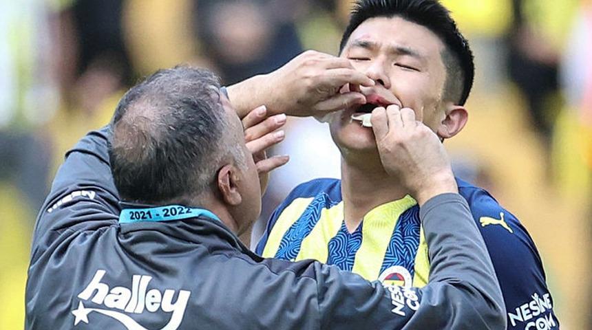 Kim Min-Jae'nin dudağı patladı!