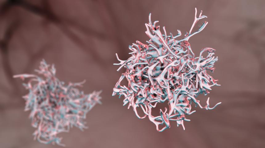 Endonezya'da dizanteri salgını