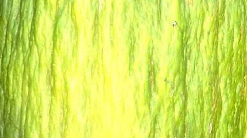 Görenler gözlerine inanamadı! 14 kiloluk acur şaşkınlığı