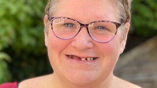 İngiltere’de diş hekimi randevusu yetersizliği: ’11 dişimi kendi ellerimle çektim’